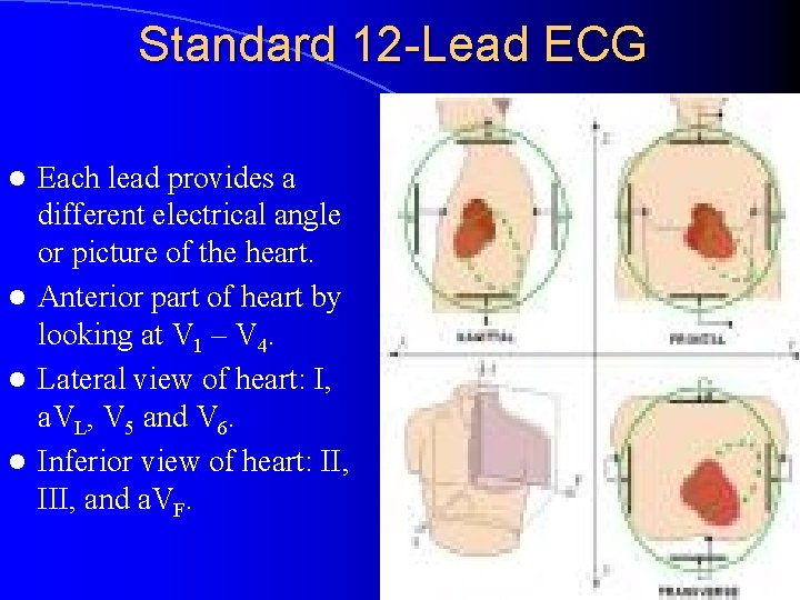 Standard 12 -Lead ECG Each lead provides a different electrical angle or picture of