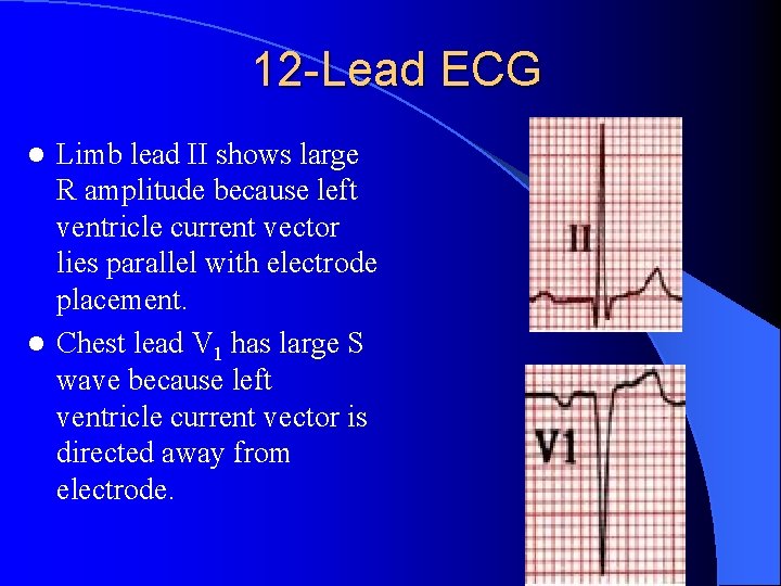 12 -Lead ECG Limb lead II shows large R amplitude because left ventricle current
