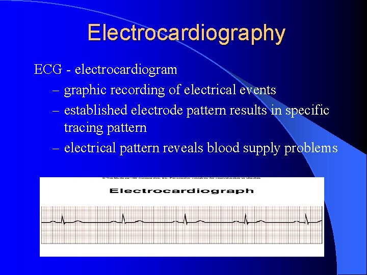 Electrocardiography ECG - electrocardiogram – graphic recording of electrical events – established electrode pattern