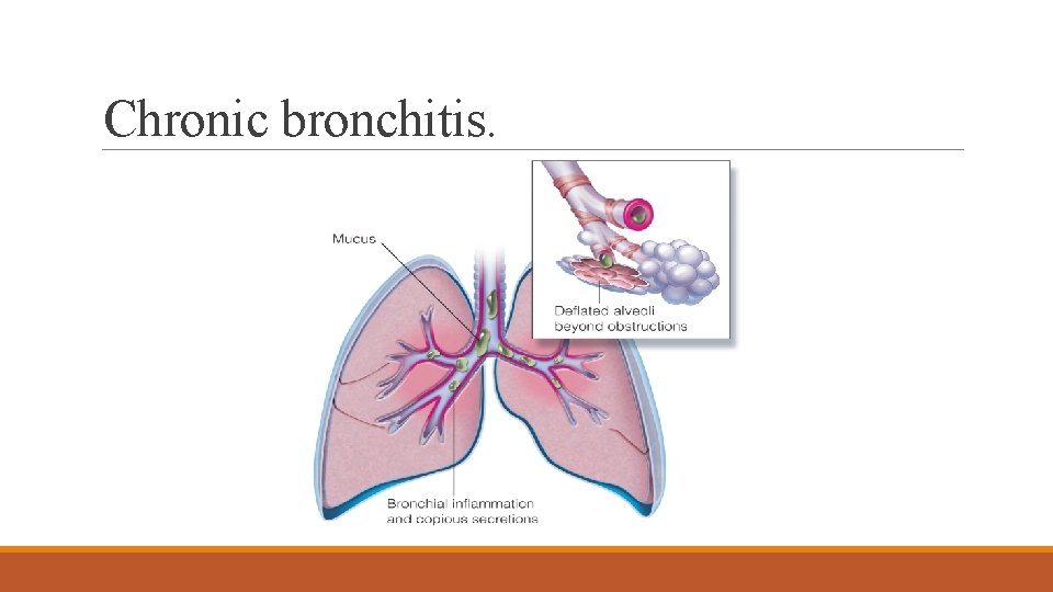 Chronic bronchitis. 