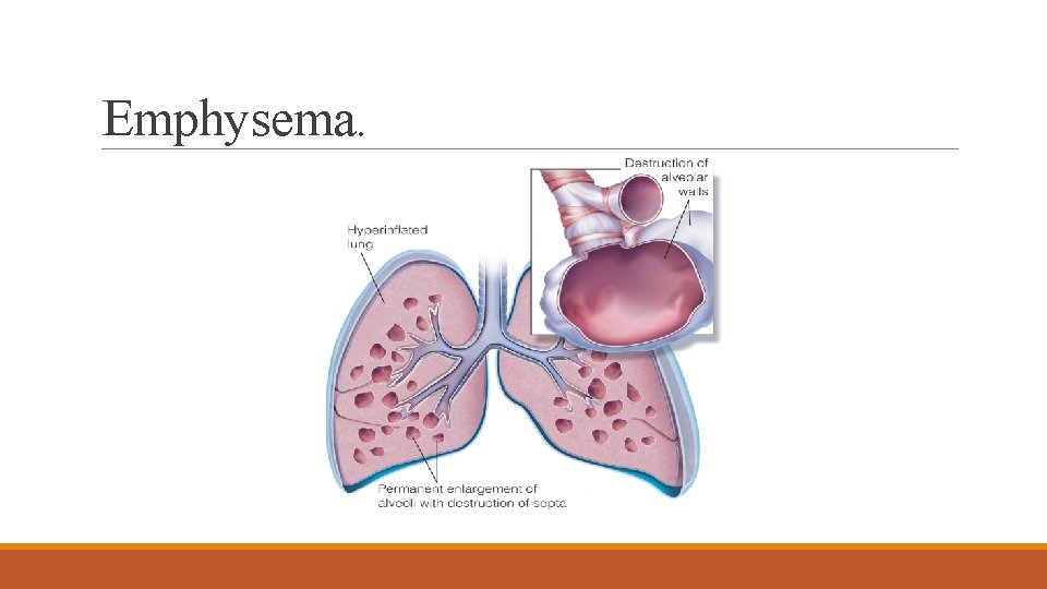 Emphysema. 