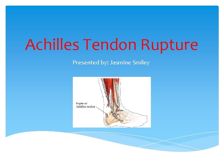 Achilles Tendon Rupture Presented by: Jasmine Smiley 
