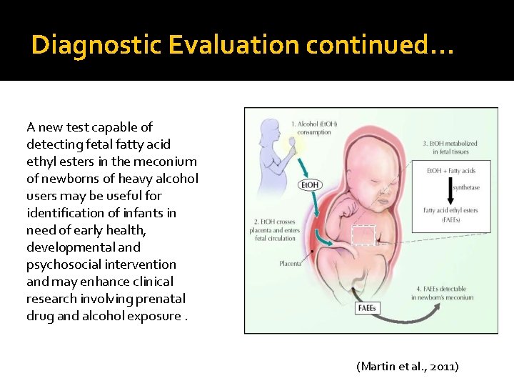 Diagnostic Evaluation continued… A new test capable of detecting fetal fatty acid ethyl esters