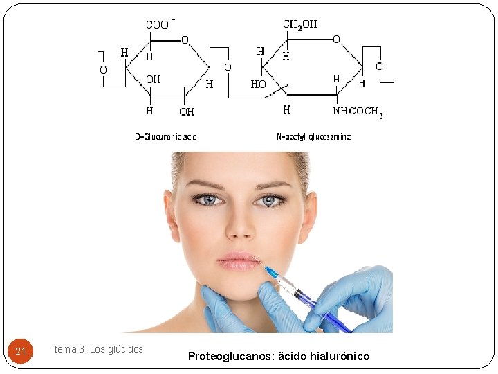 21 tema 3. Los glúcidos Proteoglucanos: äcido hialurónico 