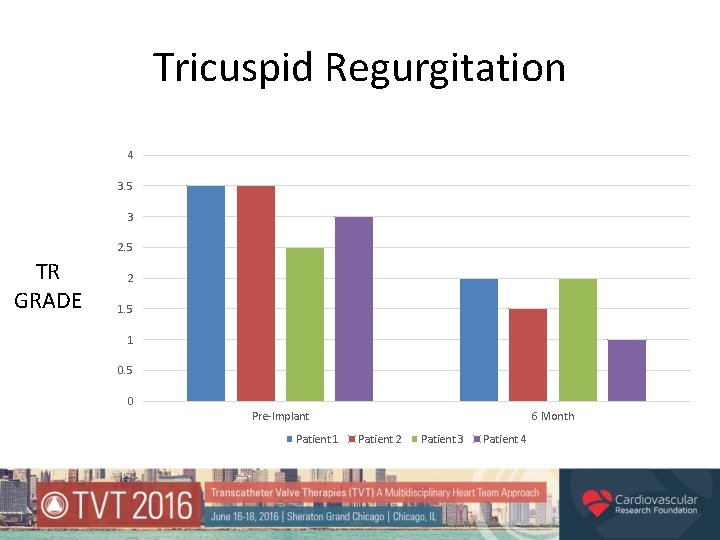 Tricuspid Regurgitation 4 3. 5 3 2. 5 TR GRADE 2 1. 5 1