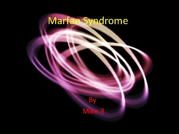 Marfan Syndrome By Mike B 