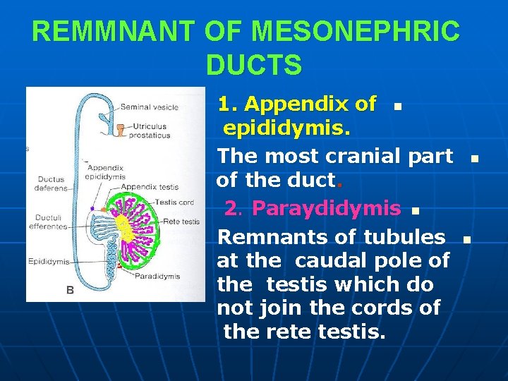 REMMNANT OF MESONEPHRIC DUCTS 1. Appendix of n epididymis. The most cranial part of REMMNANT OF MESONEPHRIC DUCTS 1. Appendix of n epididymis. The most cranial part of