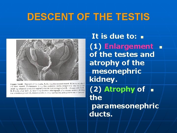 DESCENT OF THE TESTIS It is due to: n (1) Enlargement n of the DESCENT OF THE TESTIS It is due to: n (1) Enlargement n of the