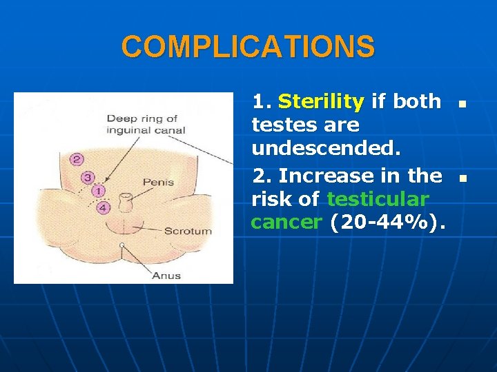 COMPLICATIONS 1. Sterility if both testes are undescended. 2. Increase in the risk of COMPLICATIONS 1. Sterility if both testes are undescended. 2. Increase in the risk of