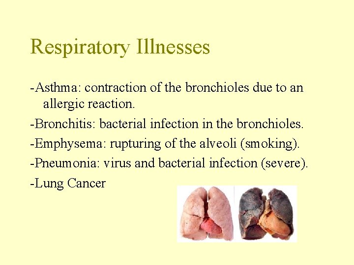 Respiratory Illnesses -Asthma: contraction of the bronchioles due to an allergic reaction. -Bronchitis: bacterial