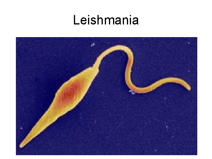 Leishmania 