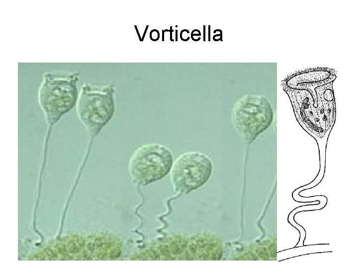 Vorticella 