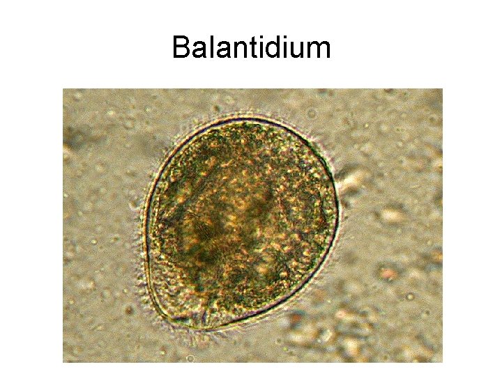 Balantidium 