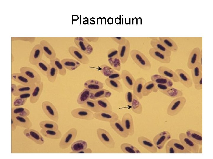 Plasmodium 