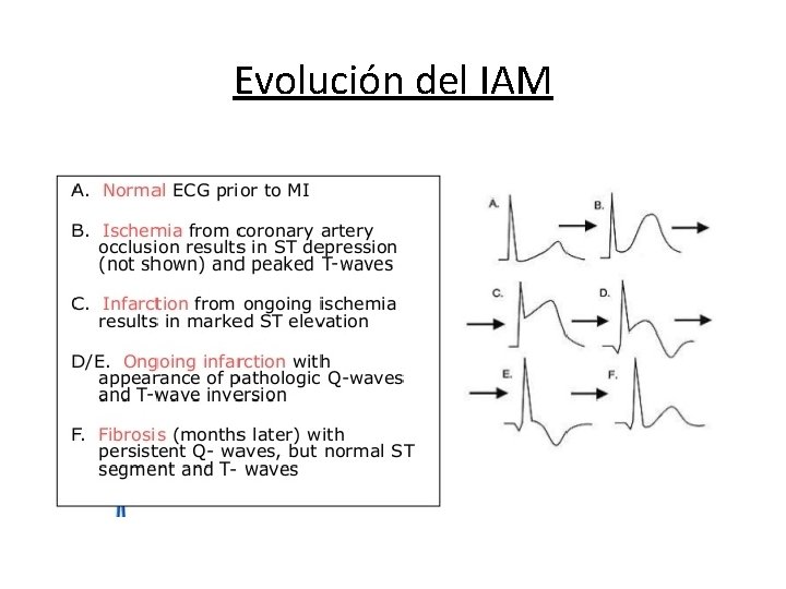 Evolución del IAM 