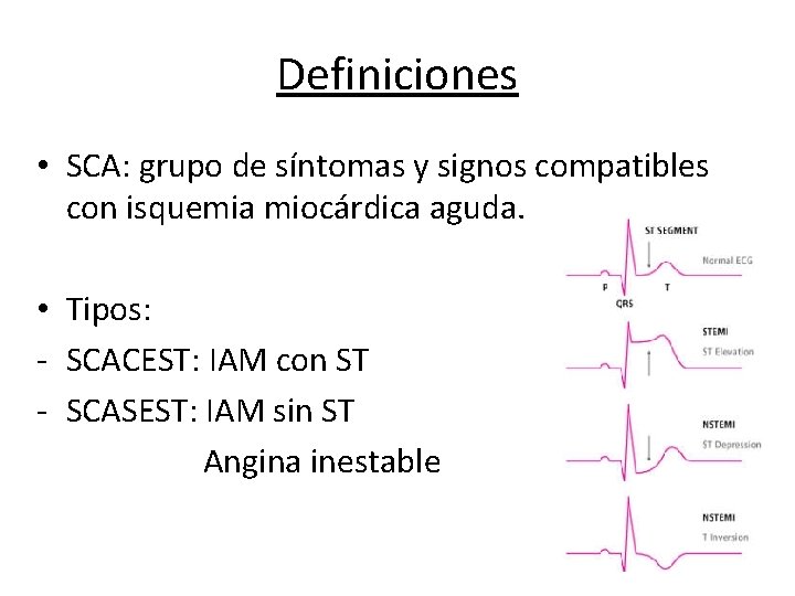 Definiciones • SCA: grupo de síntomas y signos compatibles con isquemia miocárdica aguda. •