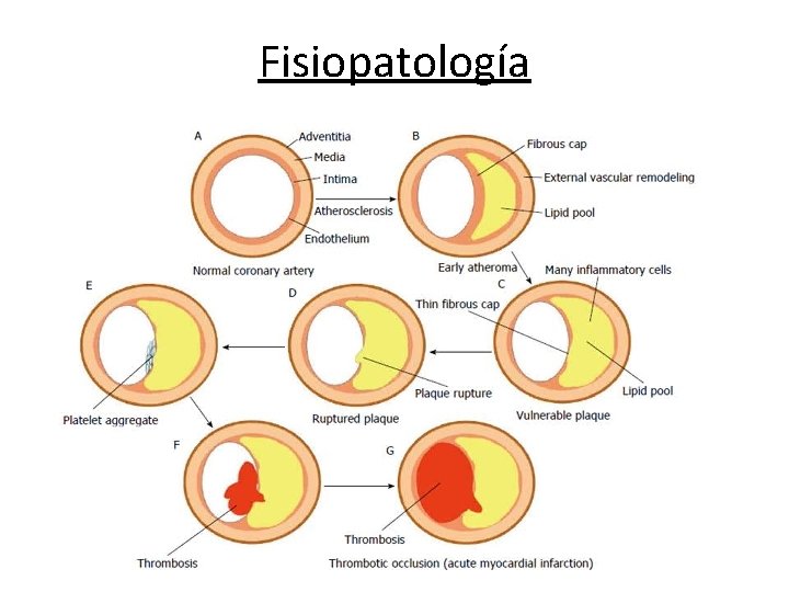 Fisiopatología 