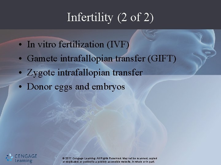 Infertility (2 of 2) • • In vitro fertilization (IVF) Gamete intrafallopian transfer (GIFT)