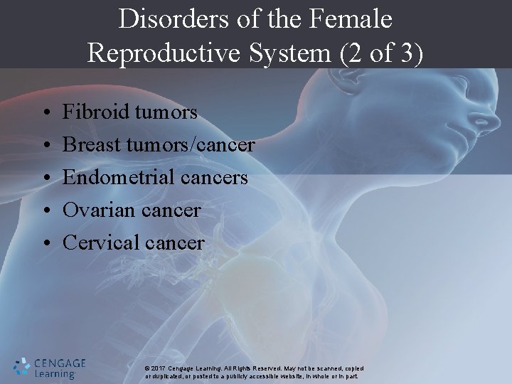 Disorders of the Female Reproductive System (2 of 3) • • • Fibroid tumors