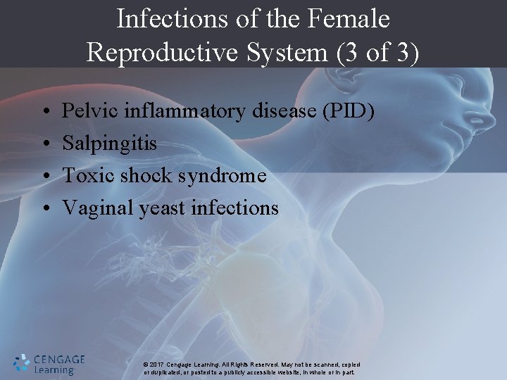 Infections of the Female Reproductive System (3 of 3) • • Pelvic inflammatory disease