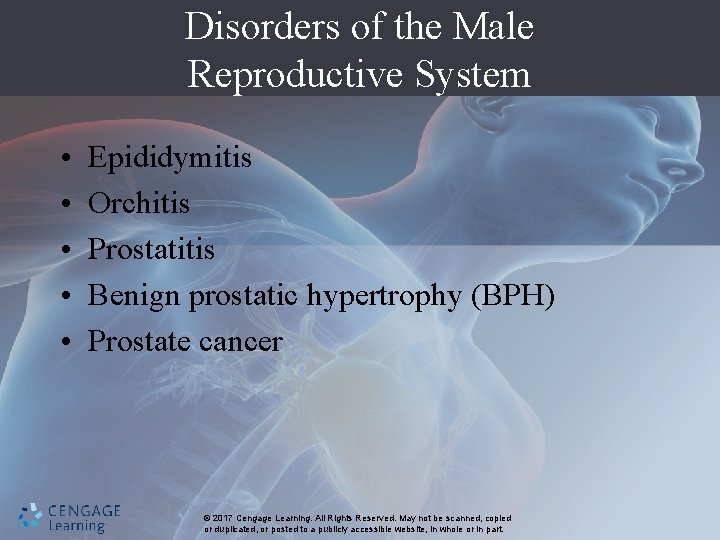 Disorders of the Male Reproductive System • • • Epididymitis Orchitis Prostatitis Benign prostatic