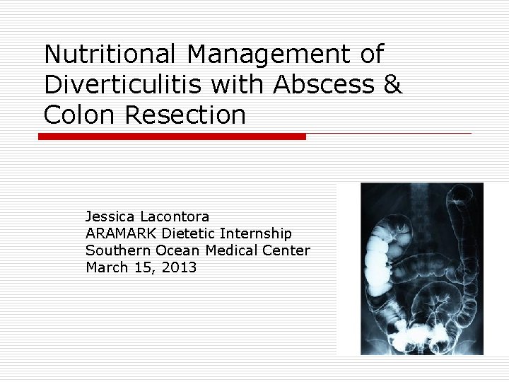 Nutritional Management of Diverticulitis with Abscess & Colon Resection Jessica Lacontora ARAMARK Dietetic Internship