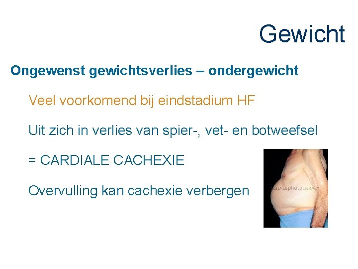 Gewicht Ongewenst gewichtsverlies – ondergewicht Veel voorkomend bij eindstadium HF Uit zich in verlies