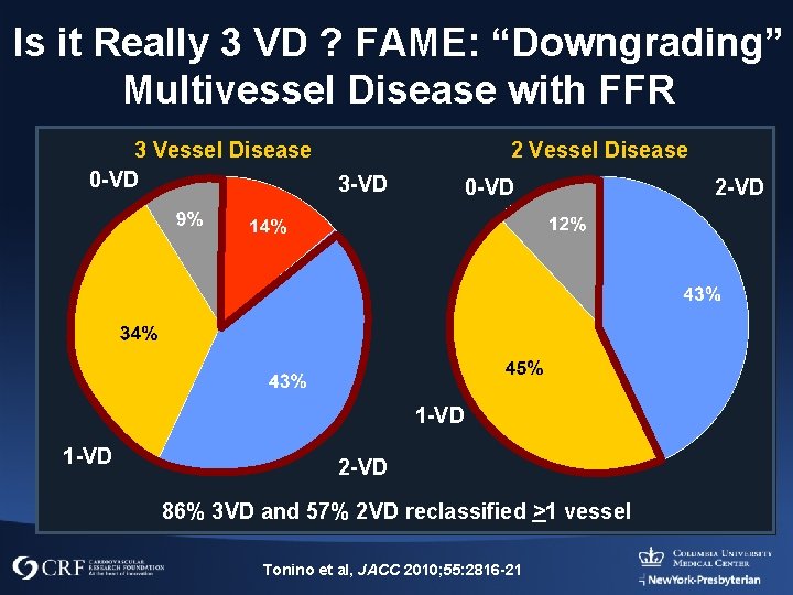 Is it Really 3 VD ? FAME: “Downgrading” Multivessel Disease with FFR 3 Vessel