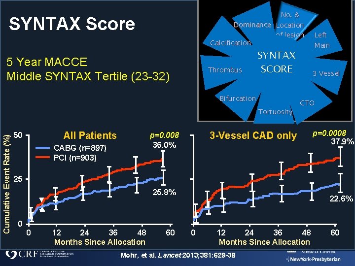 No. & Dominance Location of lesion Calcification SYNTAX Score 5 Year MACCE Middle SYNTAX