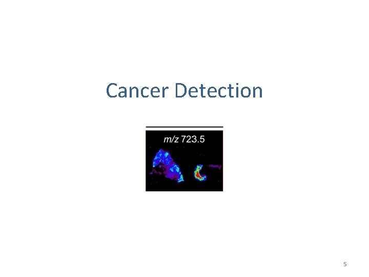 Cancer Detection 5 