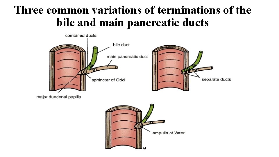 Three common variations of terminations of the bile and main pancreatic ducts 