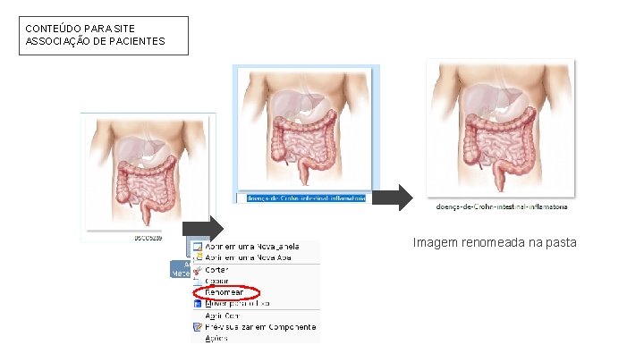 CONTEÚDO PARA SITE ASSOCIAÇÃO DE PACIENTES Imagem renomeada na pasta 