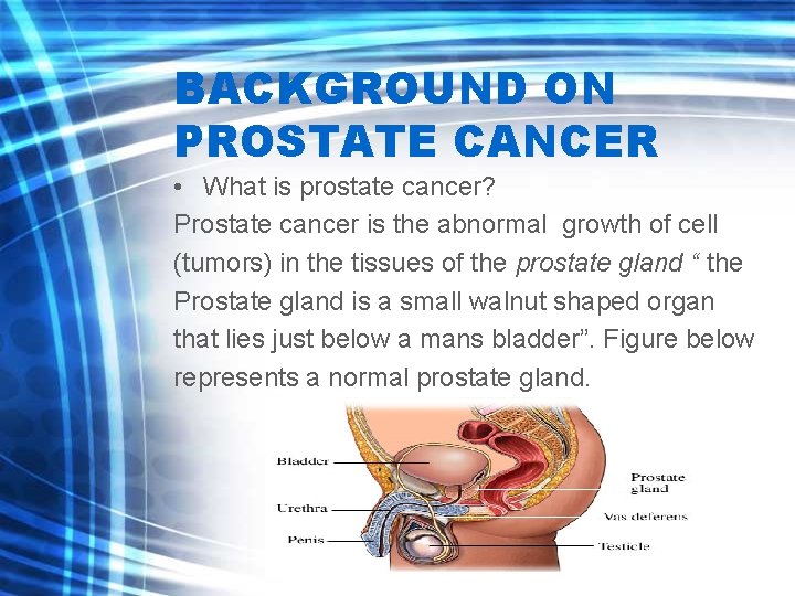 BACKGROUND ON PROSTATE CANCER • What is prostate cancer? Prostate cancer is the abnormal