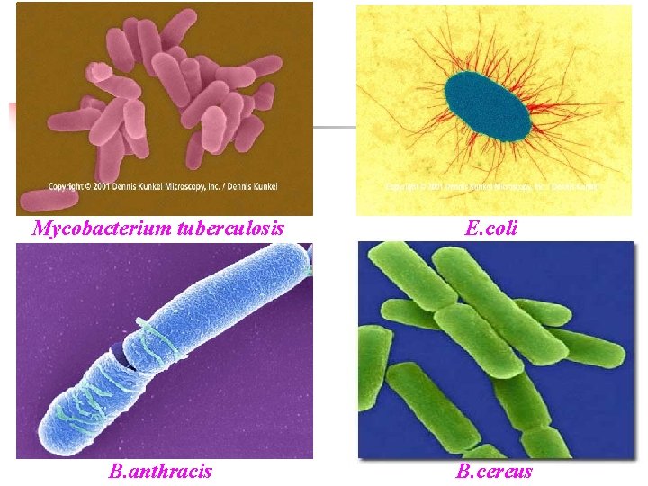 Mycobacterium tuberculosis E. coli B. anthracis B. cereus 