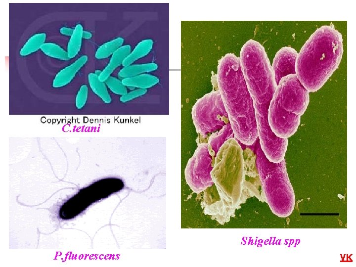 C. tetani Shigella spp P. fluorescens VK 