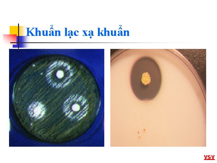 Khuẩn lạc xạ khuẩn VSV 