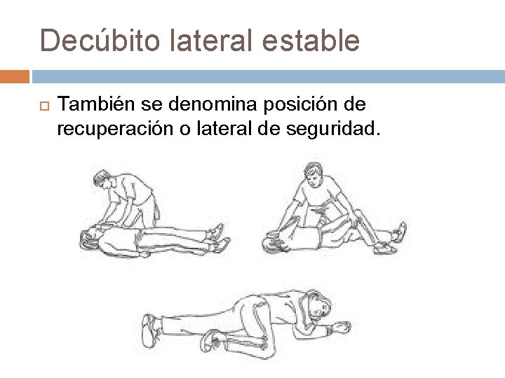 Decúbito lateral estable También se denomina posición de recuperación o lateral de seguridad. 