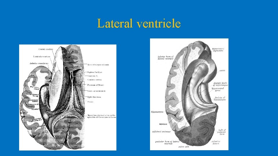 Lateral ventricle 