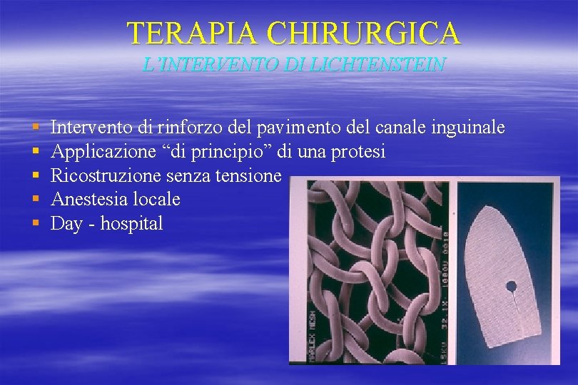 TERAPIA CHIRURGICA L’INTERVENTO DI LICHTENSTEIN § § § Intervento di rinforzo del pavimento del