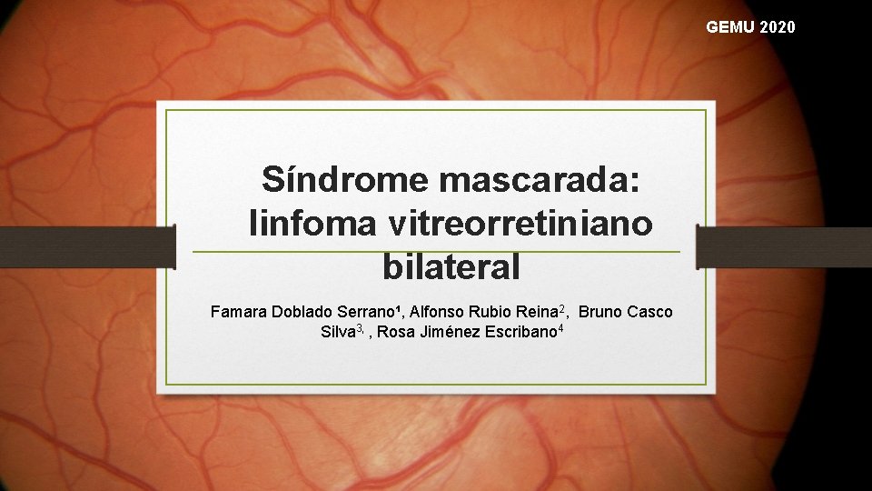 GEMU 2020 Síndrome mascarada: linfoma vitreorretiniano bilateral Famara Doblado Serrano¹, Alfonso Rubio Reina 2,