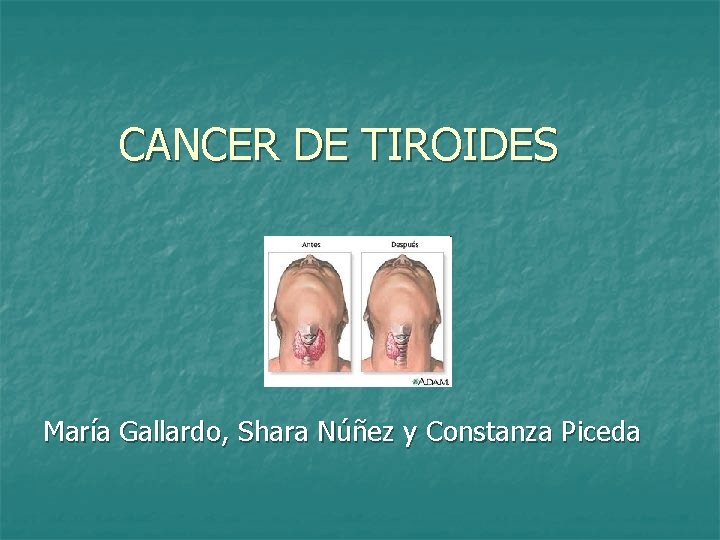 CANCER DE TIROIDES María Gallardo, Shara Núñez y Constanza Piceda 