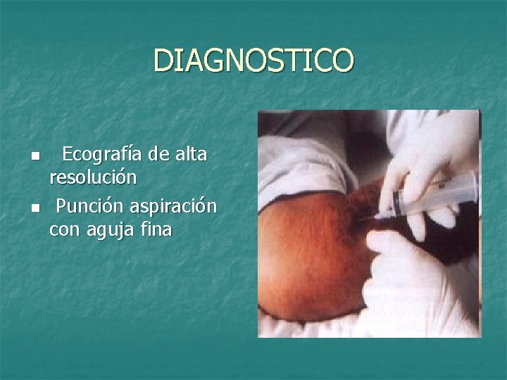 DIAGNOSTICO n n Ecografía de alta resolución Punción aspiración con aguja fina 