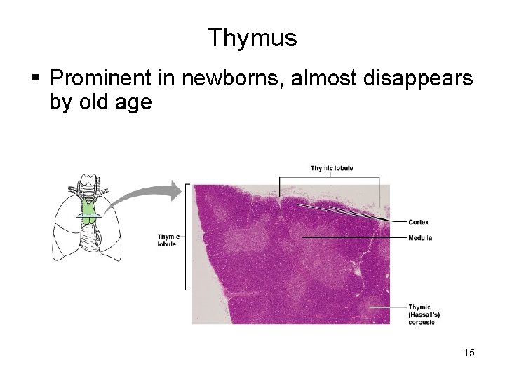 Thymus § Prominent in newborns, almost disappears by old age 15 