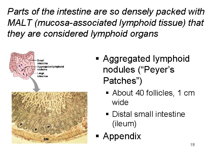Parts of the intestine are so densely packed with MALT (mucosa-associated lymphoid tissue) that