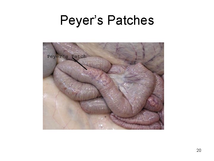 Peyer’s Patches 20 