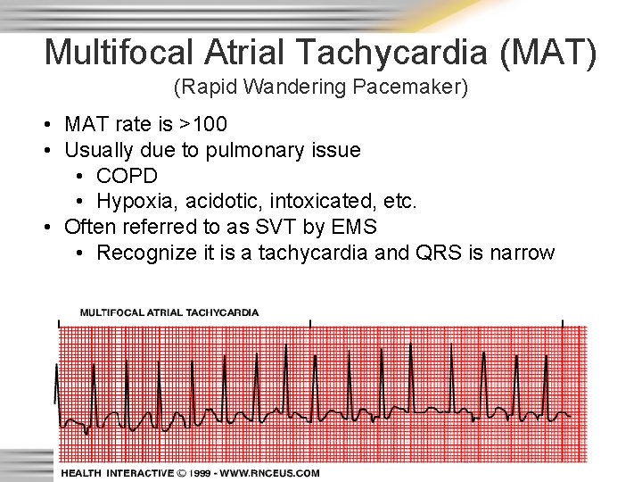 Multifocal Atrial Tachycardia (MAT) (Rapid Wandering Pacemaker) • MAT rate is >100 • Usually
