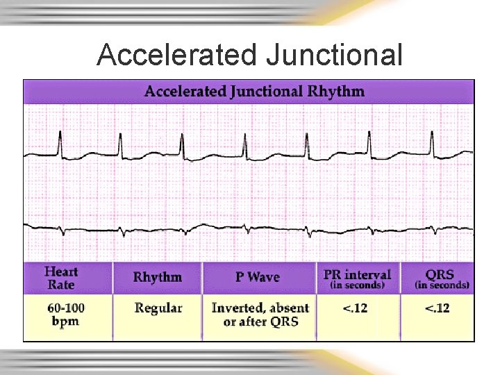 Accelerated Junctional 