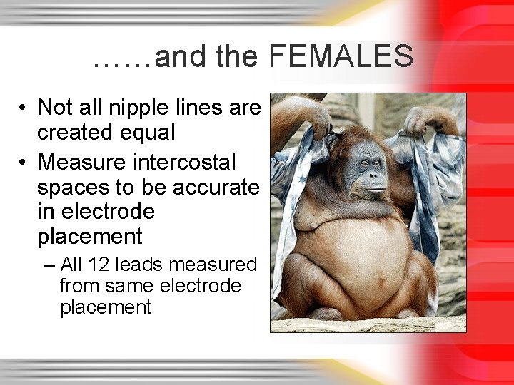 ……and the FEMALES • Not all nipple lines are created equal • Measure intercostal