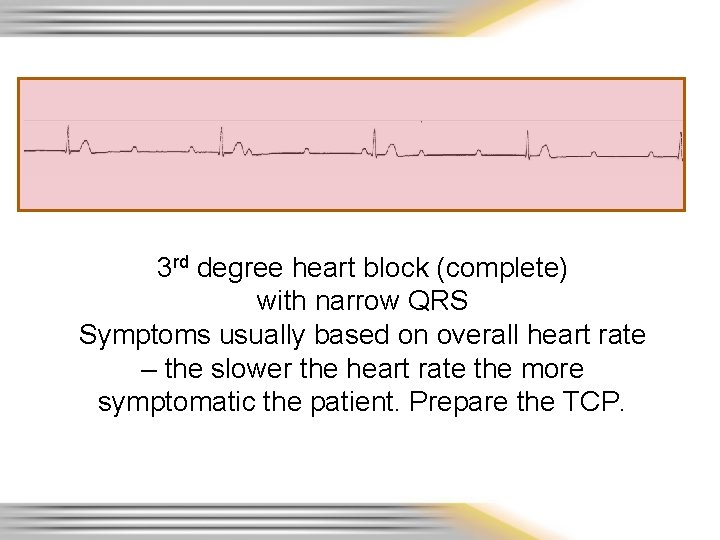 3 rd degree heart block (complete) with narrow QRS Symptoms usually based on overall