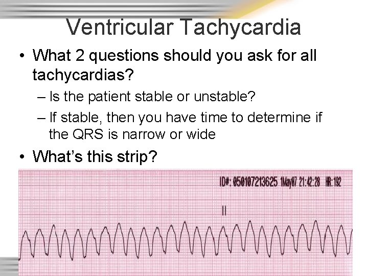 Ventricular Tachycardia • What 2 questions should you ask for all tachycardias? – Is